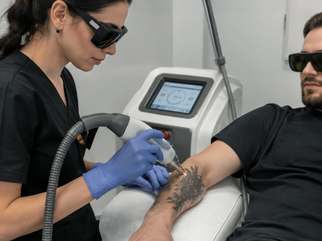 Laser Tattoo Removal